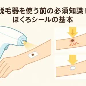 脱毛器を使う前の必須知識！ほくろシールの基本